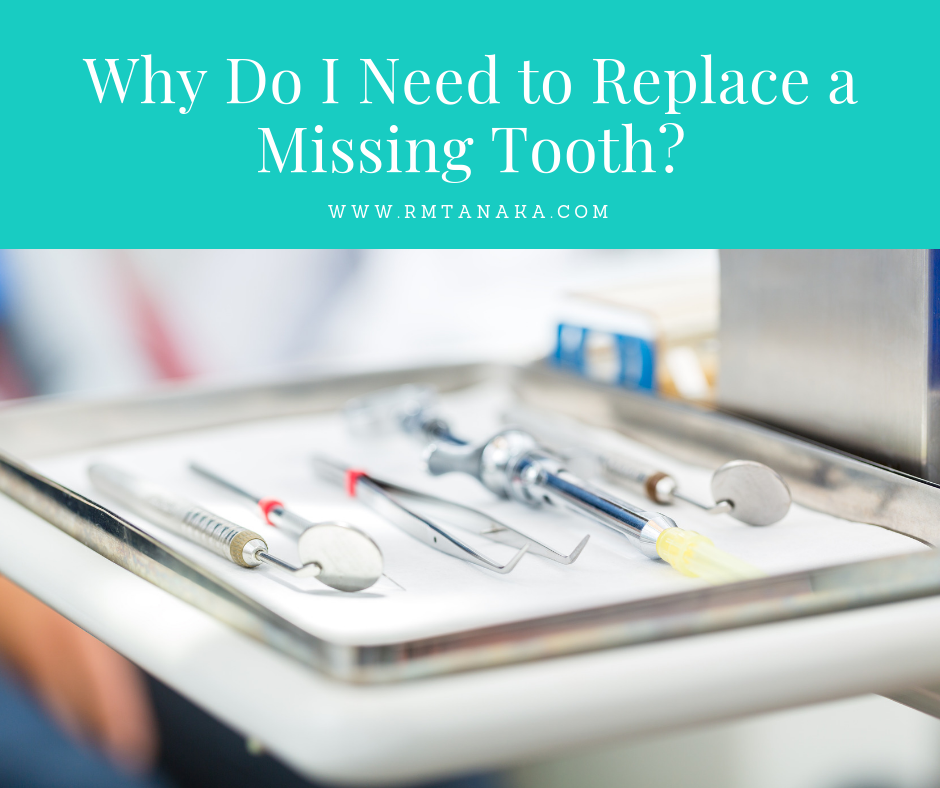 Why do I need to Replace a Missing Tooth?